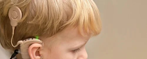 Dr Dhirendra Singh Kushwah: Importance of Cochlear Implants