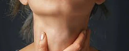 Connection Between Allergies - Dr. Dhirendra Singh Khushwah